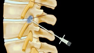 Nerve Blocks Controlling Pain and Speeding Recovery  Alyssia Howard MD [upl. by Akinak]