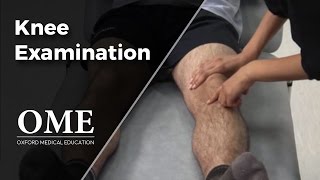 Knee Examination  Orthopaedics [upl. by Fidelis50]