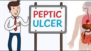 Treatment of Venous Leg Ulcers [upl. by Dinin]