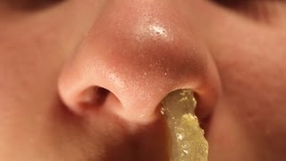 Huge Booger Removal [upl. by Iolande862]