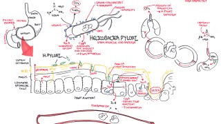 Microbiology  Helicobacter Pylori Ulcer [upl. by Nicolas]