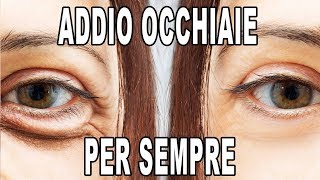 Come ELIMINARE le OCCHIAIE Per Sempre [upl. by Ordnasil]