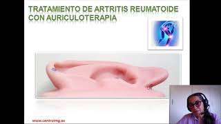 22 Artritis reumatoide Tratamiento con Auriculoterapia Centro IMG [upl. by Flam]