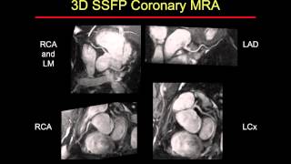 MR Angiography Techniques [upl. by Oakes]