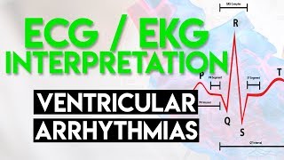 Ventricular Arrhythmias  ECG EKG Interpretation Part 5 [upl. by Ayikahs]